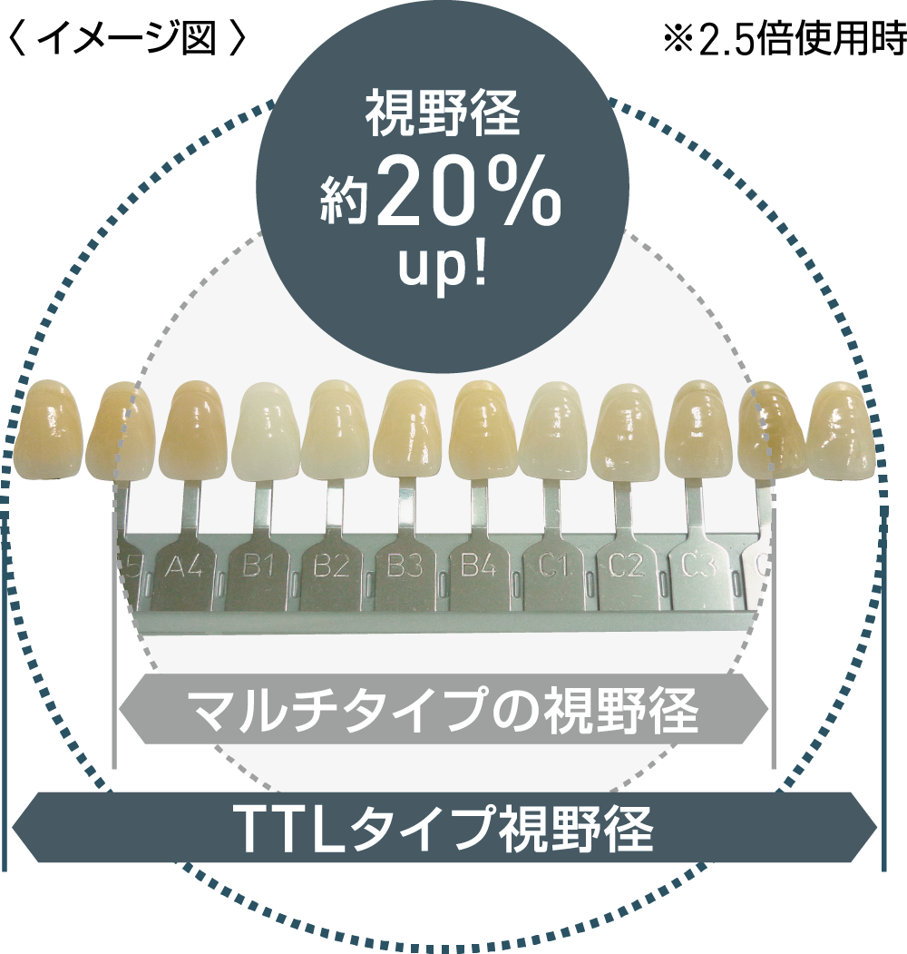 Features of TTL